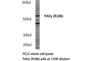 Western blot (WB) analysis of PAKγ antibody in extracts from PC12 cells. (PAK2 Antikörper)