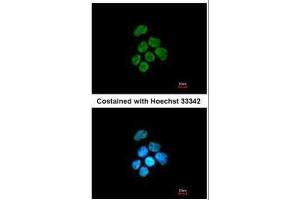 ICC/IF Image Immunofluorescence analysis of paraformaldehyde-fixed A431, using hnRNP K, antibody at 1:200 dilution. (HNRNPK Antikörper)