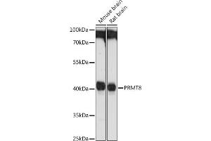 Western blot analysis of extracts of various cell lines, using PRMT8 antibody (ABIN1682310, ABIN3015998 and ABIN3015999) at 1:1000 dilution. (PRMT8 Antikörper)