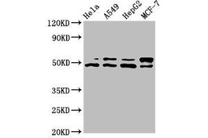 Western Blot Positive WB detected in: Hela whole cell lysate, A549 whole cell lysate, HepG2 whole cell lysate, MCF-7 whole cell lysate All lanes: AKT1 antibody at 7. (AKT1 Antikörper  (AA 1-480))