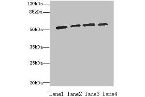 Western blot All lanes: ETNK1 antibody at 0. (Ethanolamine Kinase 1 Antikörper  (AA 90-258))