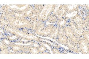 Immunohistochemistry (IHC) image for anti-Caspase 1 (CASP1) (AA 120-297) antibody (ABIN7437272)