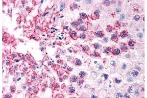 Human Testis (formalin-fixed, paraffin-embedded) stained with TFF2 antibody ABIN351426 at 15 ug/ml followed by biotinylated goat anti-rabbit IgG secondary antibody ABIN481713, alkaline phosphatase-streptavidin and chromogen. (Trefoil Factor 2 Antikörper  (Internal Region))