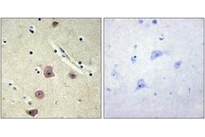 Immunohistochemistry analysis of paraffin-embedded human brain tissue, using AK5 Antibody.
