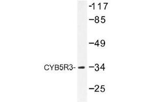 Image no. 2 for anti-Cytochrome B5 Reductase 3 (CYB5R3) antibody (ABIN317921) (CYB5R3 Antikörper)