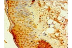 Immunohistochemistry of paraffin-embedded human skin tissue using ABIN7145488 at dilution of 1:100 (DEFB4A Antikörper  (AA 1-64))