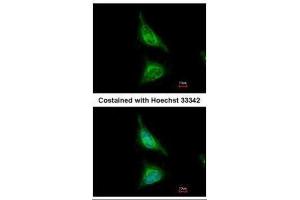Immunofluorescence (IF) image for anti-Achalasia, Adrenocortical Insufficiency, Alacrimia (AAAS) (Internal Region) antibody (ABIN2854764)
