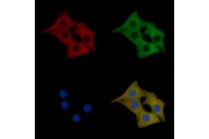PKD1/PKC mu Mouse Monoclonal Antibody staining Hela cells by IF/ICC. (PKC mu Antikörper)
