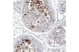Immunohistochemical staining (Formalin-fixed paraffin-embedded sections) of human testis shows strong positivity in a subset of cells in seminiferous tubules. (CXORF61 Antikörper)