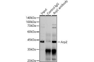 Immunoprecipitation analysis of 300 μg extracts of C6 cells using 3 μg Arp2 antibody (ABIN7265391). (ACTR2 Antikörper)