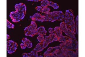 IF analysis of SRPRA using anti-SRPRA antibody (ABIN7601408). (SRPRA (AA 346-638) Antikörper)