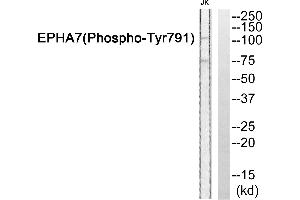 Western blot analysis of extracts from JurKat cells, using EPHA7 (Phospho-Tyr791) antibody.