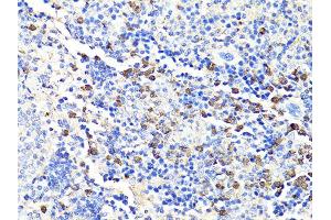 Immunohistochemistry of paraffin-embedded mouse spleen using S100A9 antibody. (S100A9 Antikörper)
