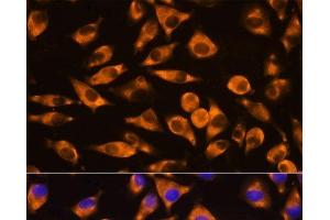 Immunofluorescence analysis of L929 cells using CEP55 Polyclonal Antibody at dilution of 1:100. (CEP55 Antikörper)