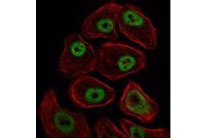 Immunofluorescence analysis of NIH/3T3 cells using SMC1 mouse mAb (green). (SMC1A Antikörper)