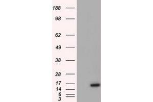 HEK293T cells were transfected with the pCMV6-ENTRY control (Left lane) or pCMV6-ENTRY BIRC5 (Right lane) cDNA for 48 hrs and lysed. (Survivin Antikörper)