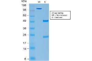 SDS-PAGE Analysis Purified ACTH Mouse Recombinant Monoclonal Antibody (rCLIP/1407).