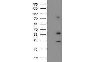 Image no. 1 for anti-Cytochrome B5 Reductase 1 (CYB5R1) antibody (ABIN1497691) (CYB5R1 Antikörper)
