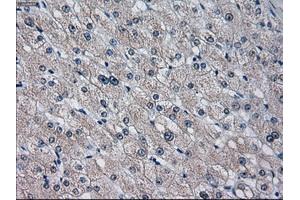 Immunohistochemical staining of paraffin-embedded endometrium tissue using anti-CYP2E1 mouse monoclonal antibody. (CYP2E1 Antikörper)