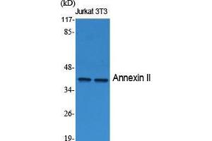 Western Blot (WB) analysis of specific cells using Annexin II Polyclonal Antibody. (Annexin A2 Antikörper  (Internal Region))