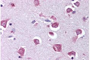 Human Brain, Cortex (formalin-fixed, paraffin-embedded) stained with RELA antibody ABIN218582 at 1:500 followed by biotinylated goat anti-rabbit IgG secondary antibody ABIN481713, alkaline phosphatase-streptavidin and chromogen. (NF-kB p65 Antikörper  (pSer529))