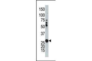 The anti-AK2 Pab (ABIN392741 and ABIN2842198) is used in Western blot to detect AK2 in mouse kidney tissue lysate. (Adenylate Kinase 2 Antikörper  (N-Term))