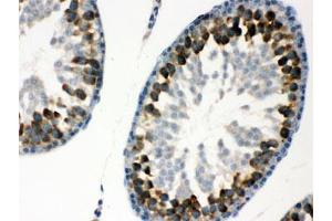 IHC testing of FFPE rat testis with YB1 antibody. (YBX1 Antikörper)