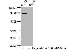 Western Blot Positive WB detected in HepG2 whole cell lysate(treated with Calyculin A or not) All lanes Phospho-STAT1 antibody at 1. (Rekombinanter STAT1 Antikörper  (pSer727))