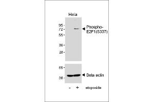 Western blot analysis of lysates from Hela cell line, untreated or treated with etoposide(25μM, 24h), using Phospho-E2F1 Antibody (upper) or Beta-actin (lower). (E2F1 Antikörper  (pSer337))