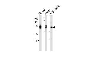 LCK Antibody ABIN1882258 western blot analysis in HL-60,Jurkat,NCI- cell line lysates (35 μg/lane). (LCK Antikörper)