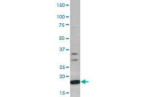 Western Blot (Cell lysate) analysis of CEM cell lysate with Histone H3 (phospho S10) polyclonal antibody .