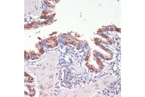 Immunohistochemistry of paraffin-embedded rat lung using Musashi-1 (Musashi-1 (MSI1)) antibody (ABIN6134835, ABIN6144067, ABIN6144068 and ABIN6219720) at dilution of 1:200 (40x lens). (MSI1 Antikörper  (AA 1-100))