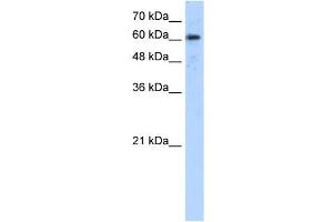 ADAM30 antibody used at 5 ug/ml to detect target protein. (ADAM30 Antikörper  (N-Term))