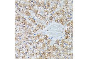 Immunohistochemistry of paraffin-embedded rat liver using IVD antibody (ABIN7268031) at dilution of 1:100 (40x lens). (IVD Antikörper  (AA 33-200))