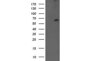 Western Blotting (WB) image for anti-Cytochrome P450, Family 2, Subfamily J, Polypeptide 2 (CYP2J2) antibody (ABIN1497729) (CYP2J2 Antikörper)