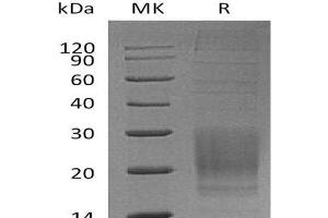 Inducible T-Cell Co-Stimulator (ICOS) protein (His tag)