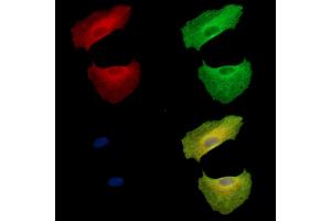 ABIN7095041 and ABIN7099097 staining  cells by IF/ICC. (SBEM Antikörper)