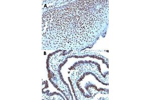 Immunohistochemical staining (Formalin-fixed paraffin-embedded sections) of human tonsil (A) and human ovarian carcinoma (B) with Histone H1 monoclonal antibody, clone AE-4 .