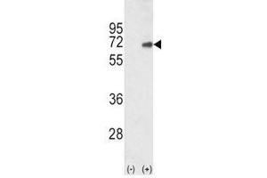 Western blot analysis of SMAD4 antibody and 293 cell lysate (2 ug/lane) either nontransfected (Lane 1) or transiently transfected with the human gene (2). (SMAD4 Antikörper  (AA 400-428))