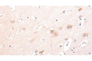 Immunohistochemistry of paraffin-embedded Human brain using TRAF3IP1 Polyclonal Antibody at dilution of 1:70
