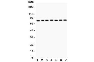 Western blot testing of MAD1 antibody and human samples 1:  A549;  2: Jurkat;  3: HeLa;  4: 293T;  5: SHG-44;  6: 22RV1;  7: PANC lysate. (PSMD14 Antikörper  (AA 362-632))