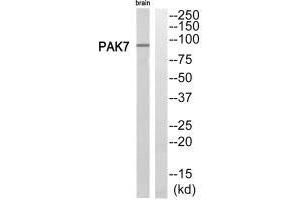 Western blot analysis of extracts from rat brain cells, using PAK7 antibody. (PAK7 Antikörper  (C-Term))