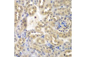 Immunohistochemistry of paraffin-embedded mouse kidney using SULT2B1 antibody (ABIN2737623) at dilution of 1:100 (40x lens). (SULT2B1 Antikörper)