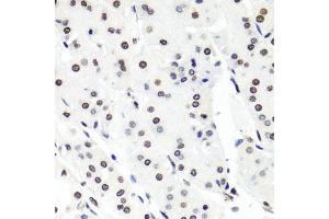 Immunohistochemistry of paraffin-embedded human stomach using HIST1H2BG antibody. (HIST1H2BG Antikörper)