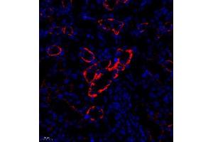 Immunofluorescence analysis of paraffin embedded rat nephritis using CD35 (ABIN7073563) at dilution of 1: 650 (CD35 Antikörper)