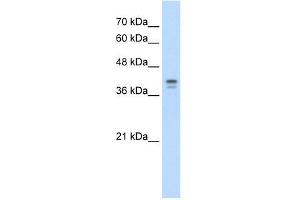 Loricrin antibody used at 5 ug/ml to detect target protein.