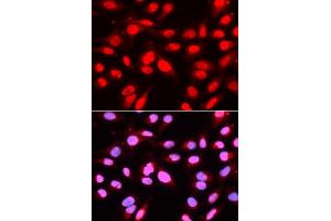 Immunofluorescence analysis of U2OS cells using U2AF2 antibody (ABIN5971000). (U2AF2 Antikörper)