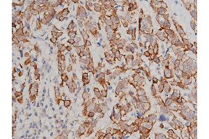 Immunohistochemistry (IHC) image for anti-Keratin 8 (KRT8) (pSer432) antibody (ABIN6255334)