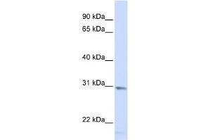 SMUG1 antibody used at 1 ug/ml to detect target protein. (SMUG1 Antikörper  (Middle Region))