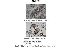 Immunohistochemistry (IHC) image for anti-Matrix Metallopeptidase 19 (MMP19) (N-Term) antibody (ABIN2779559)